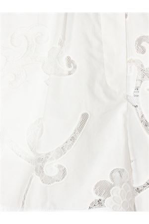 White Embroidered Poplin Shorts SEMI COUTURE | S6SL11A030